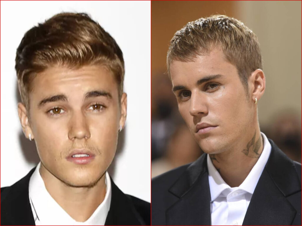 Wie alt ist Justin Bieber – und warum sein Leben bis heute fasziniert Wie alt ist Justin Bieber